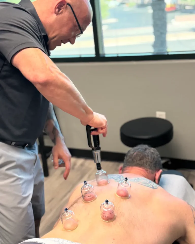 Dr. Tim Ballitch applying cupping therapy to a patient's upper back at Muscle Chiropractic in Glendale